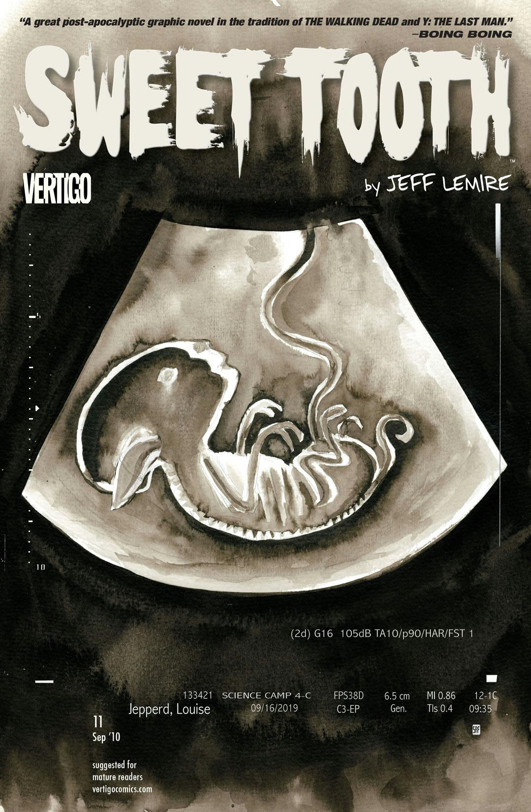 Sweet Tooth #11 preview images